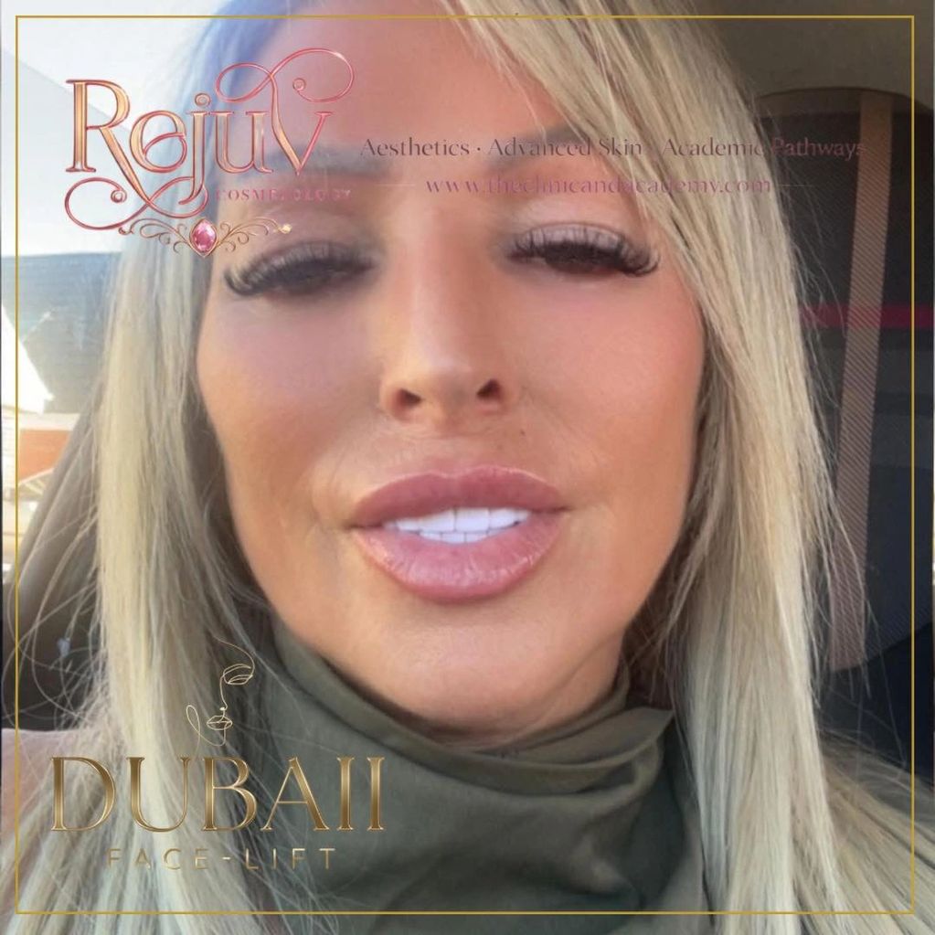 Close-up of a woman with blonde hair and enhanced facial features, promoting Dubai face-lift services.