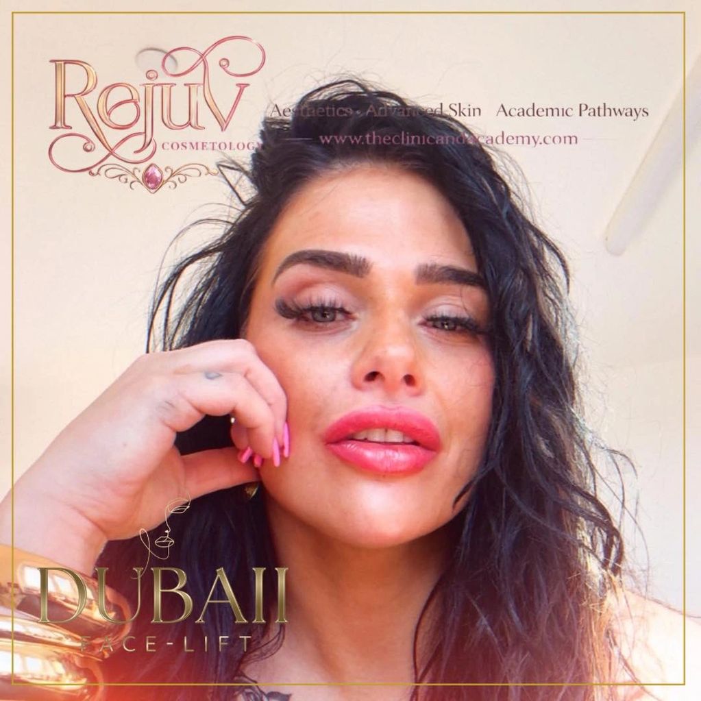 Close-up of a woman with bold makeup and dark hair, promoting Dubai face-lift by Rojuv Cosmetology.