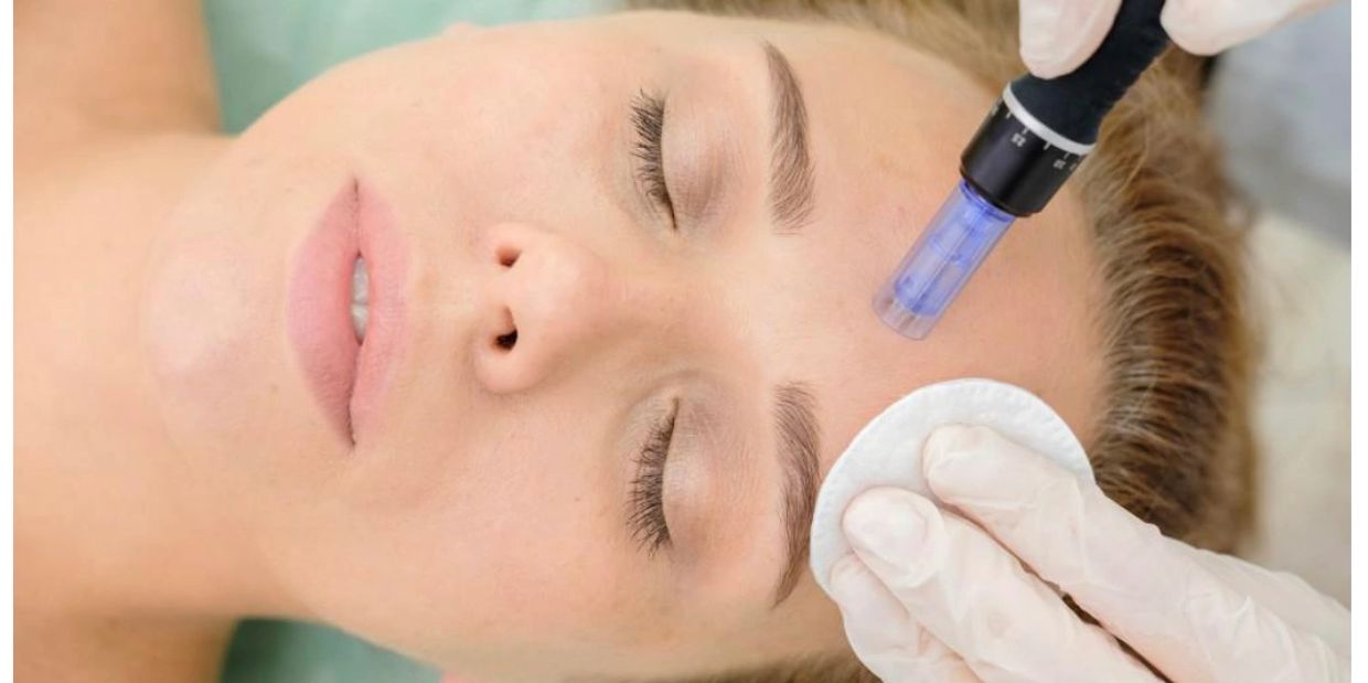 Microneedling, skincare, collagen induction, facial , Kansas City, KC, KCMO , corrective skincare