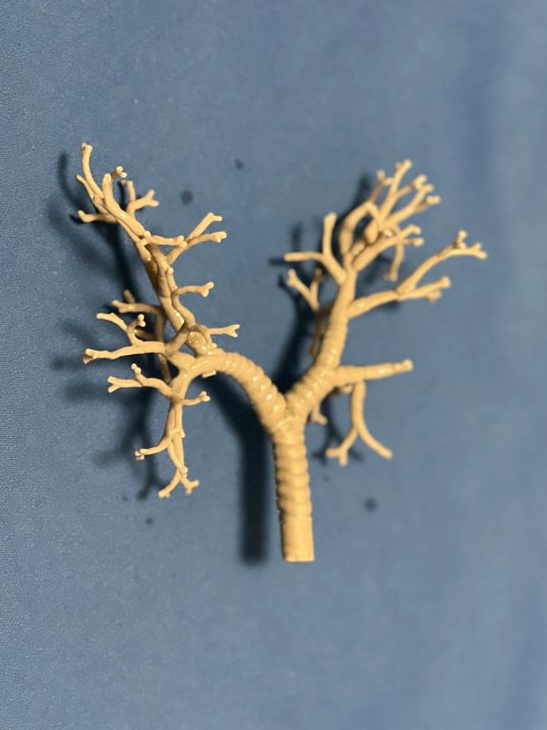 3D print maquette of bronchial tree for respiratory therapy model.