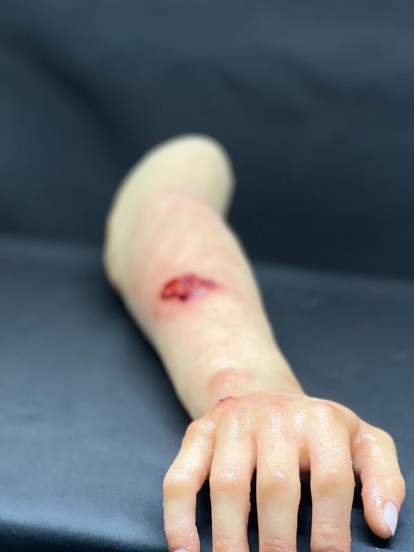Realistic arm with acute traumatic injuries.  Arm bleeds, moves, pulses, and is warm to the touch. 