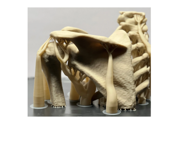 3D printing of complex structures, like a shoulder, are possible with AI driven support structures.