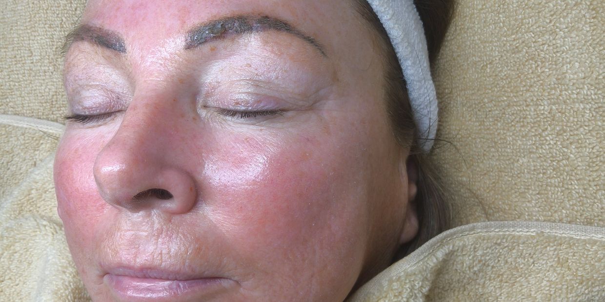 Woman with closed eyes resting with a headband.