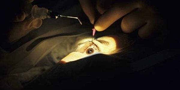 surgery for cataract