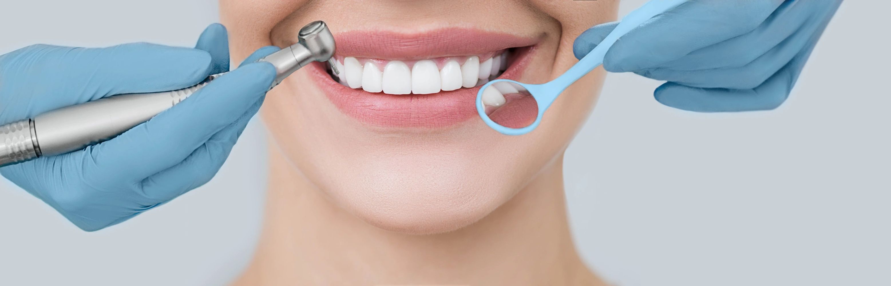 Dental Implants Services Tijuana Mx