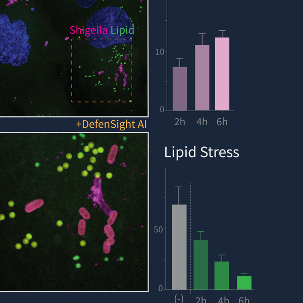 Multiplex sub-diffraction imaging of lipid flux and Shigella proliferation in infected human cells. 