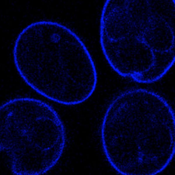 Fluorescent-nanoparticle uptake in developing Eimeria maxima cysts — label-free parasite imaging.