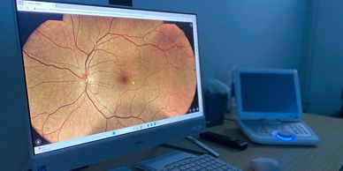 fundus photo demonstrating fundus photography