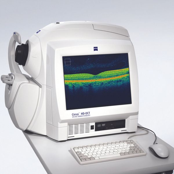 glaucoma and technology