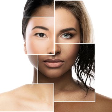 skin of color, esthetics diversity