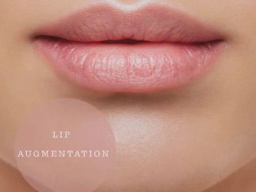 Lip Augmentation 