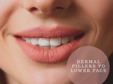 Dermal Fillers