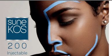 Close-up of a woman's face with blue facial lines for dermal treatment.