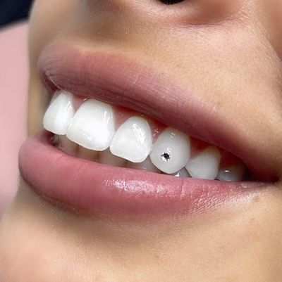 Here's What to Know Before Getting Your First Tooth Gem