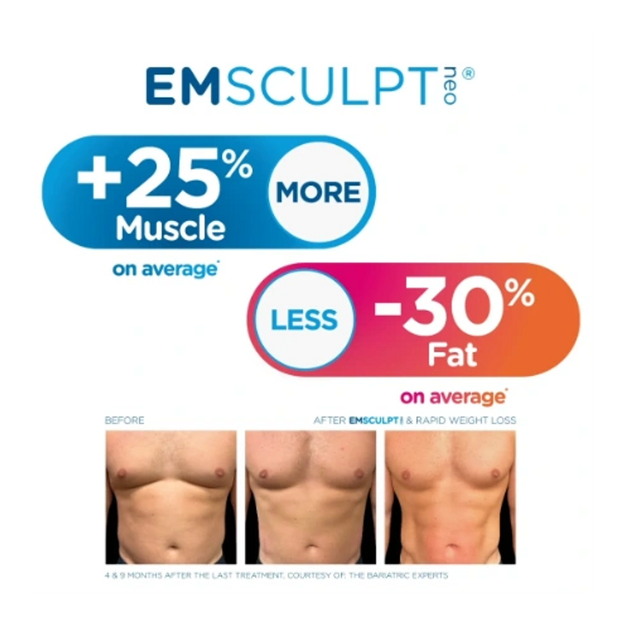 Results of EMSCULPT NEO