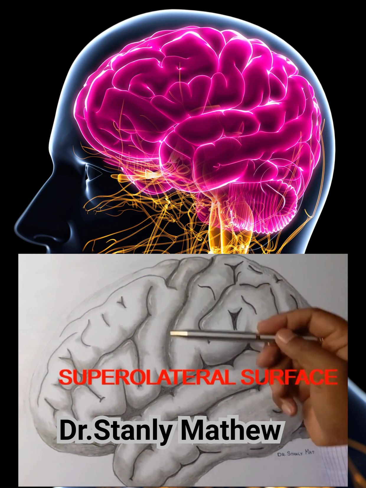 dr satnly's neuroanatomy class . demonstrating brain superolateral surface
