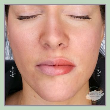 Lip Blush before and after blended photo (half of female client's face before and other half after)