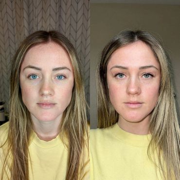 Before and After headshots of blonde female with fresh black permanent eyeliner on upper eyelids