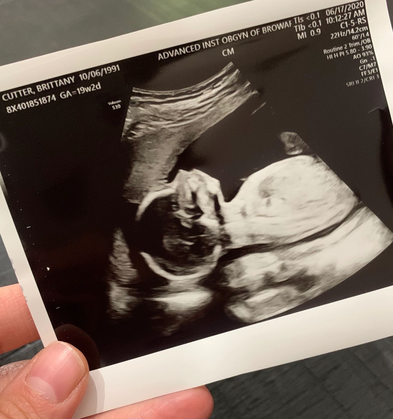 Pregnancy, Health, Wellness 