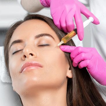 Woman is receiving PRP (Platelet Rich Plasma) injection in the face