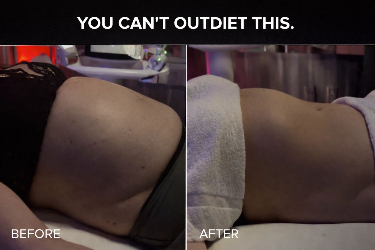 Lymphatic drainage in Boardman, Ohio for abdominal bloating, fluid retention, and swelling.