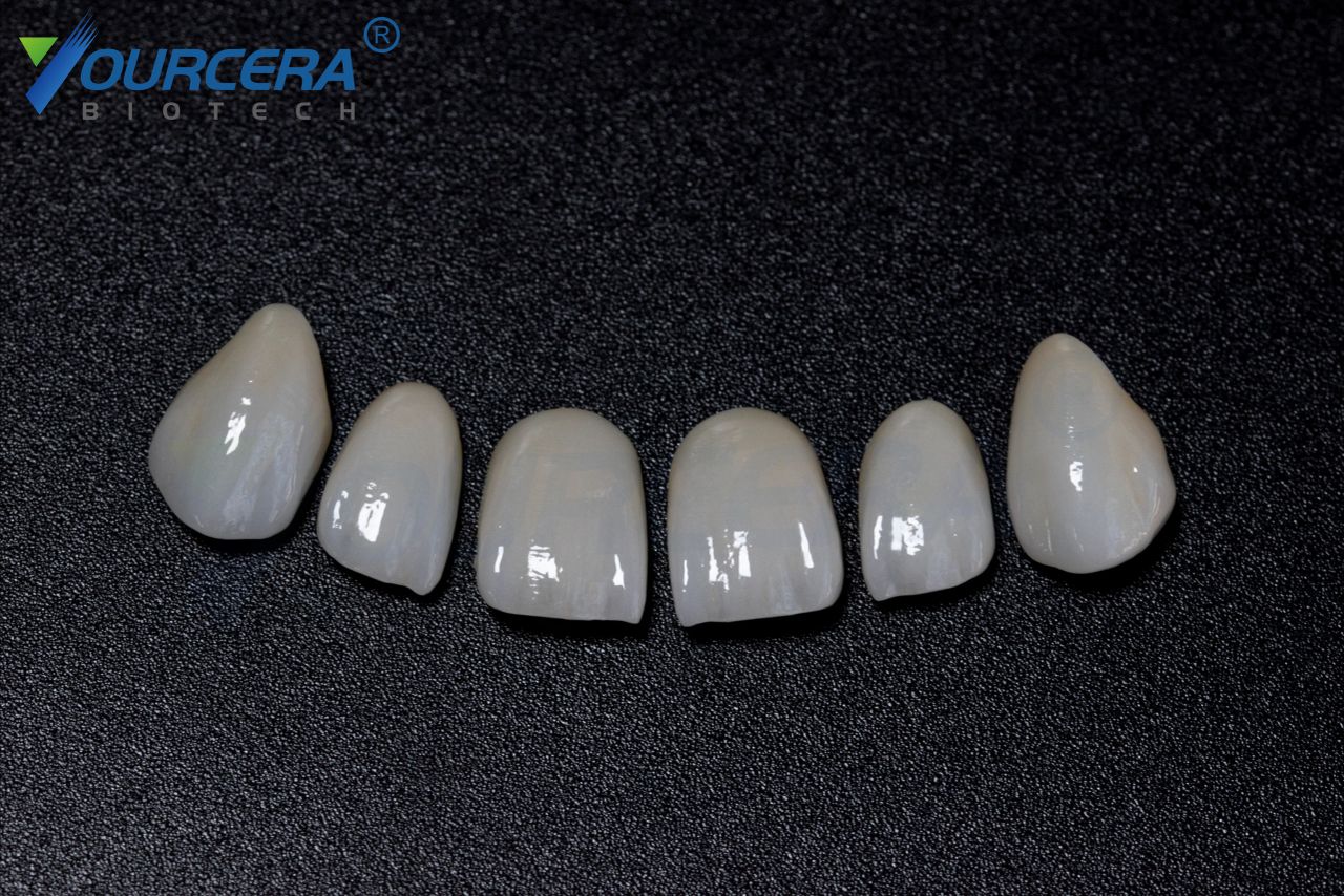 glass ceramic teeth /glass teeth