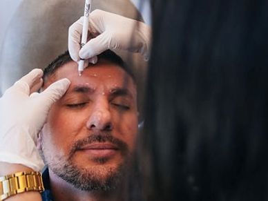 A man receiving a cosmetic facial treatment with markings on his forehead.