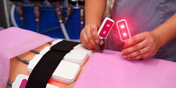 Laser lipo for weightloss