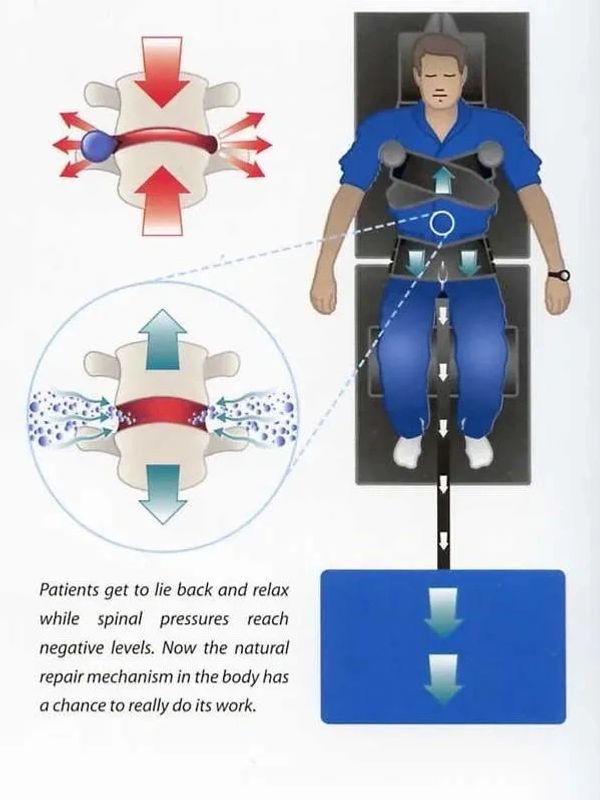 Spinal Decompression