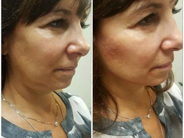 Anti aging treatments are so - MedSkin Laser Center