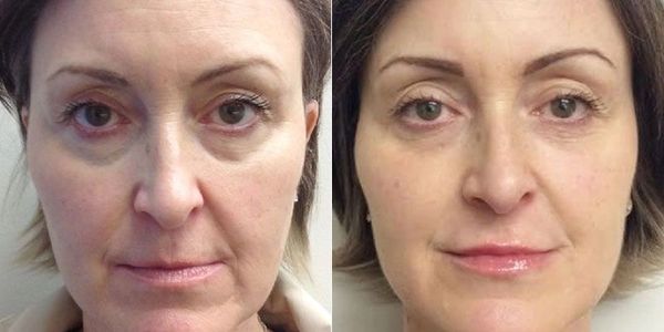 Anti aging treatments are so - MedSkin Laser Center