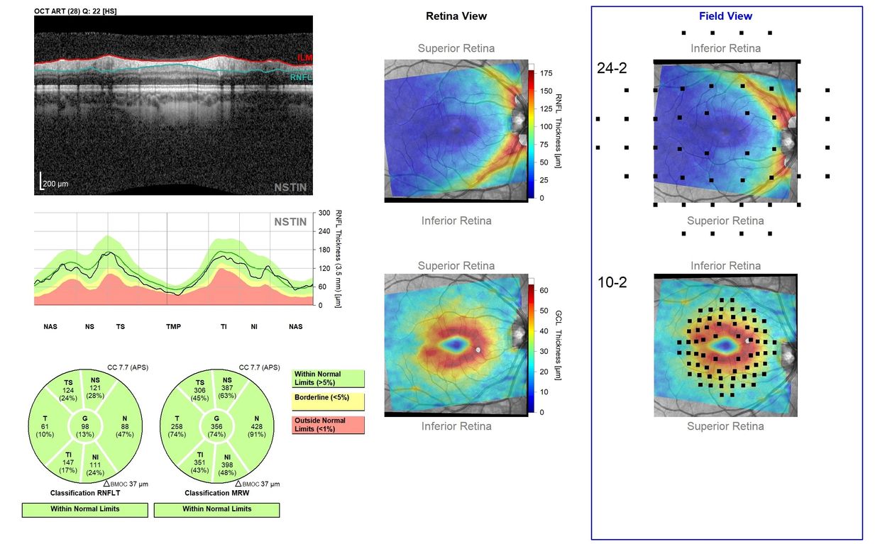 Retina and field view