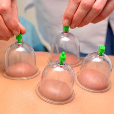 massage cupping