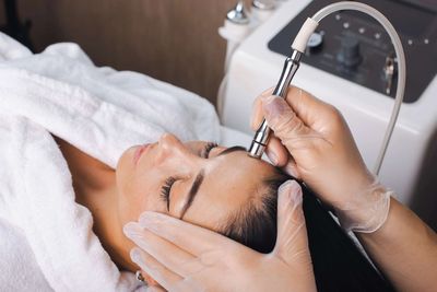 Microdermabrasion is simple, safe, inexpensive and effective
