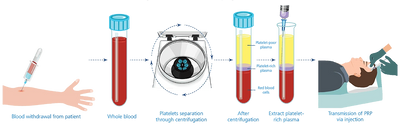 Platelet Rich Plasma ("PRP") is *your own blood* working to strengthen and repair your skin