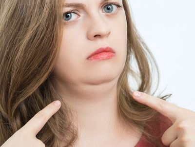 HIFU reduces your unwanted subcutaneous fat in jowls and under chin 