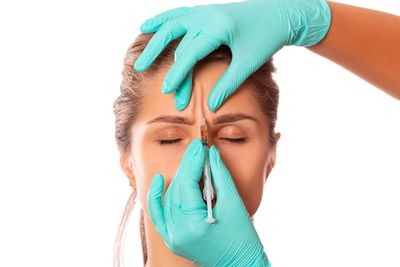 We treat all manner of facial wrinkles