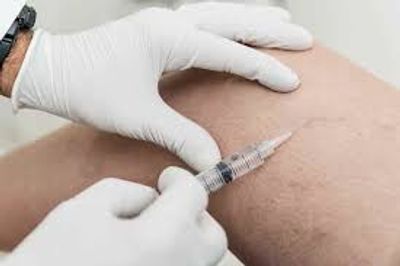 Sclerotherapy is Number One for fine leg veins 