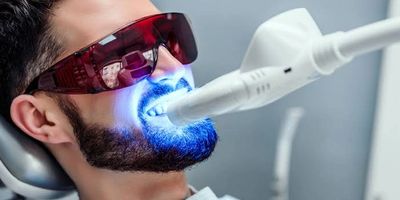 Işıklı Diş Beyazlatma