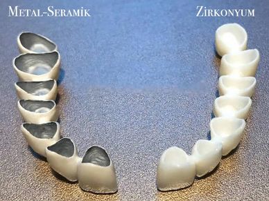 zirkonyum protez farkı 