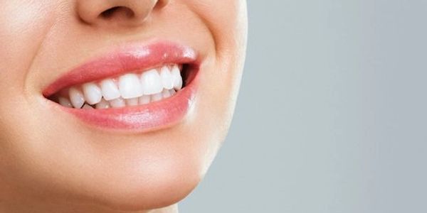 These teeth are exceptionally white, and you may be able to get the same results at home.