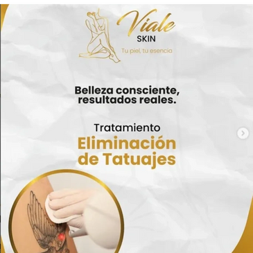 Publicidad para tratamiento de eliminación de tatuajes en Viale Skin.