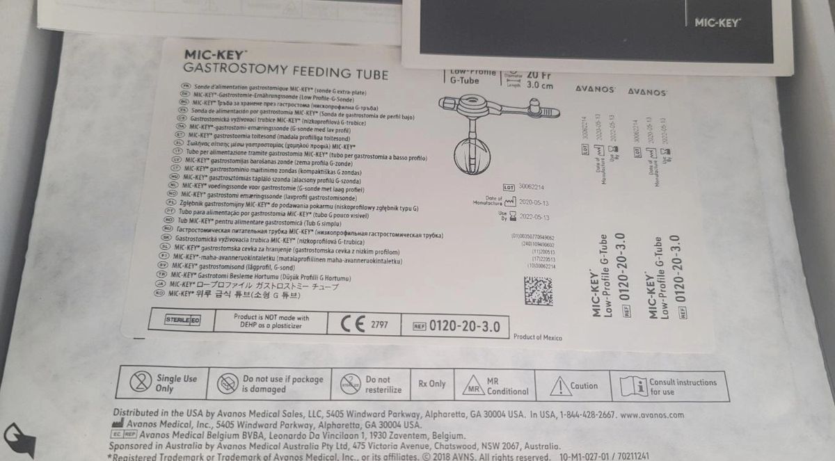 Avanos 0120203.0 MICKEY Gastrostomy Feeding Tube 20Fr, 3.0cm (X)