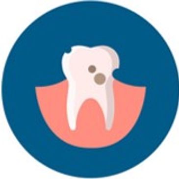 A cartoon of a damaged tooth with decay