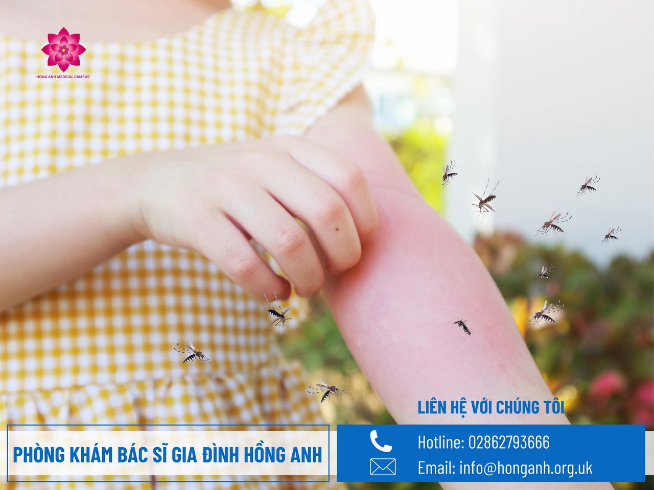 Sốt xuất huyết Sốt xuất huyết