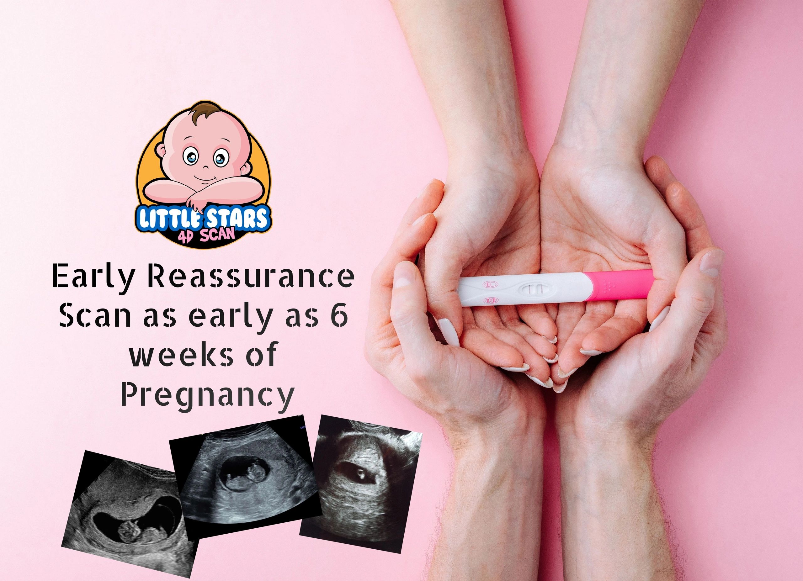 Little Stars 4D Scan: Your Premier Early Pregnancy Scan Clinic