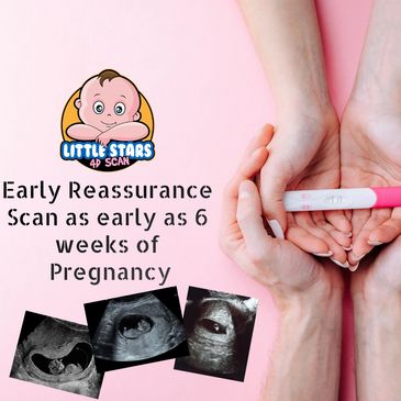 Early Pregnancy Scan in just £75 - Little Stars 4D Scan - Pregnancy Scan Clinic - Positive Pregnancyt