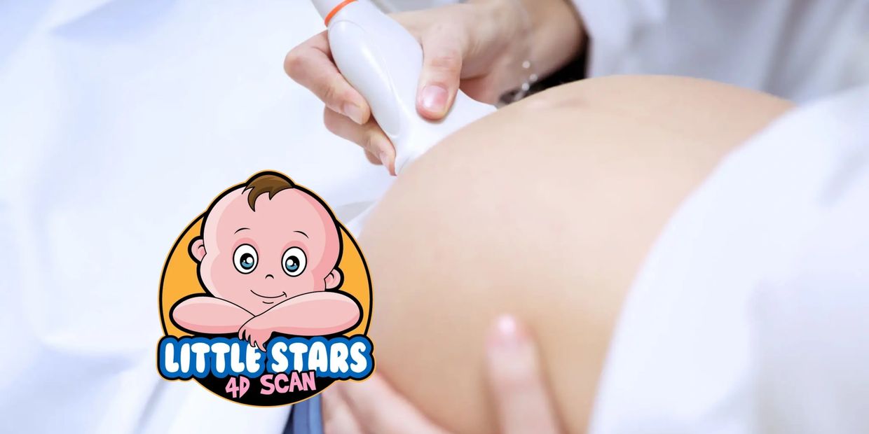 Reduced Fetal Movement Scan | Fetal Monitoring Scan | Pregnancy Scan Clinic | Reassurance Scan