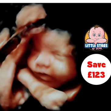 Peace-of-Mind 7 Scan bundle £500 by little stars 4d scan, Little Stars 4D Scan, remove your pregnanc