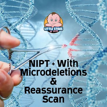 NIPT, Non invasive prenatal testing, nipt test nottingham, nipt test derby, nipt loughborough